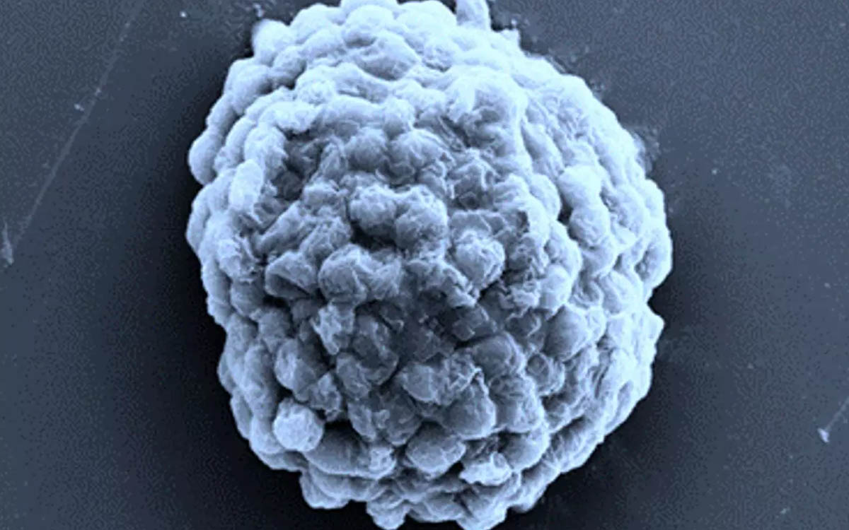Imagen recogida por un microscopio electrónico de una gota de células de algas productoras de hidrógeno de 10 micrómetros. Foto: Profesor Xin Huang, Instituto de Tecnología de Harbin