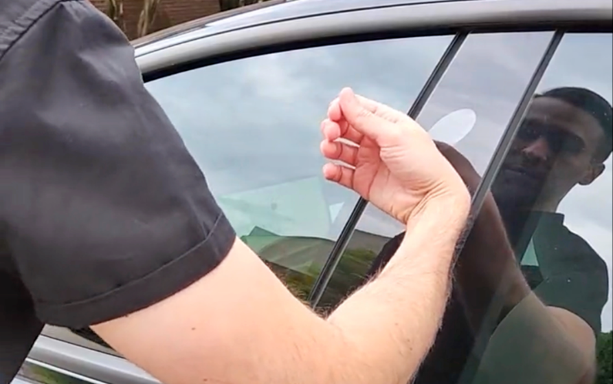  Este peculiar propietario de Tesla se ha implantado el chip de control en la mano 