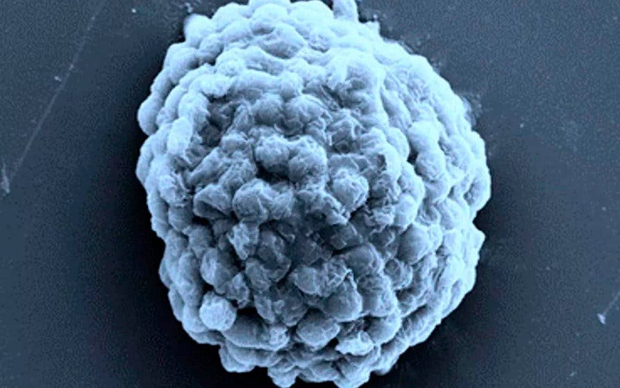 Imagen recogida por un microscopio electrónico de una gota de células de algas productoras de hidrógeno de 10 micrómetros. Foto: Profesor Xin Huang, Instituto de Tecnología de Harbin 